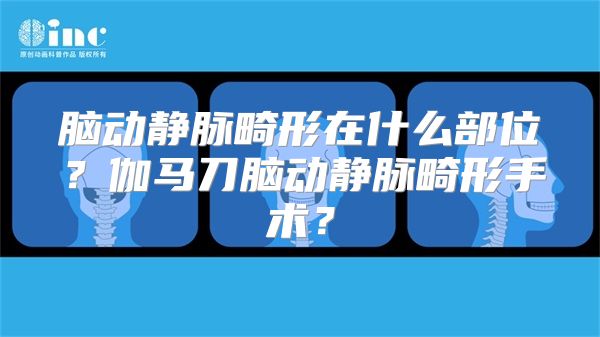 脑动静脉畸形在什么部位？伽马刀脑动静脉畸形手术？