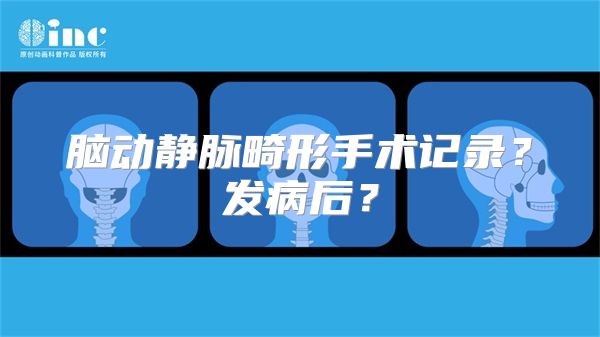 脑动静脉畸形手术记录？发病后？