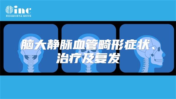 脑大静脉血管畸形症状、治疗及复发