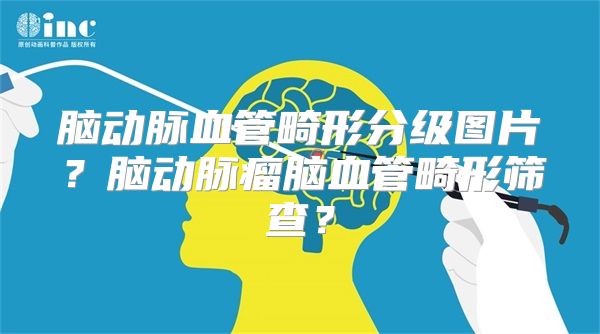 脑动脉血管畸形分级图片？脑动脉瘤脑血管畸形筛查？