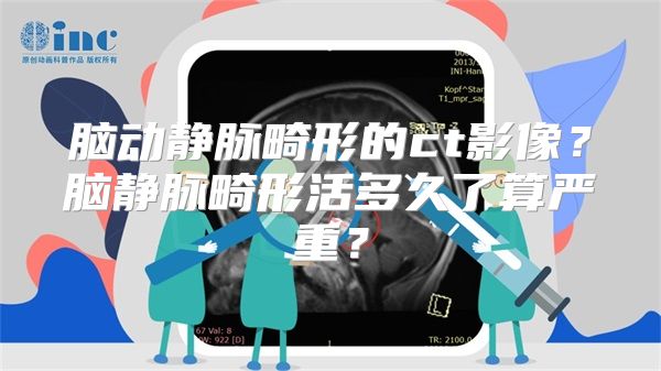 脑动静脉畸形的ct影像？脑静脉畸形活多久了算严重？