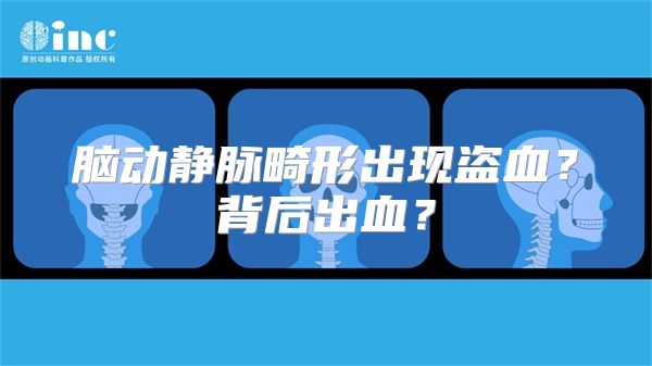 脑动静脉畸形出现盗血？背后出血？