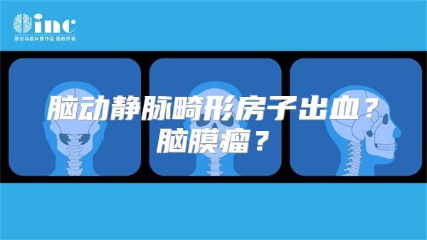 脑动静脉畸形房子出血？脑膜瘤？