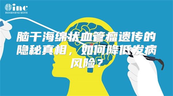 脑干海绵状血管瘤遗传的隐秘真相，如何降低发病风险？